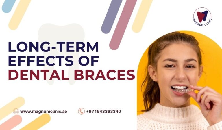 Long Term Effects Of Dental Braces Positive Effects Of Braces On Your