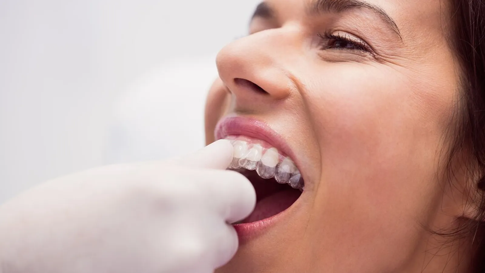 Patient in dental chair during teeth extraction consultation