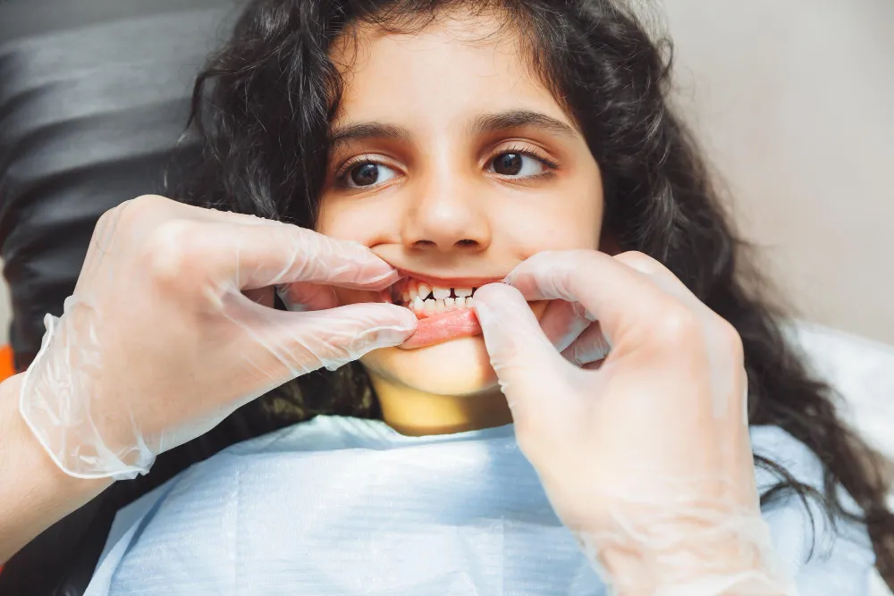 The "Anchor" of Your Smile: Why Cuspid Teeth are Critical for Dental Health