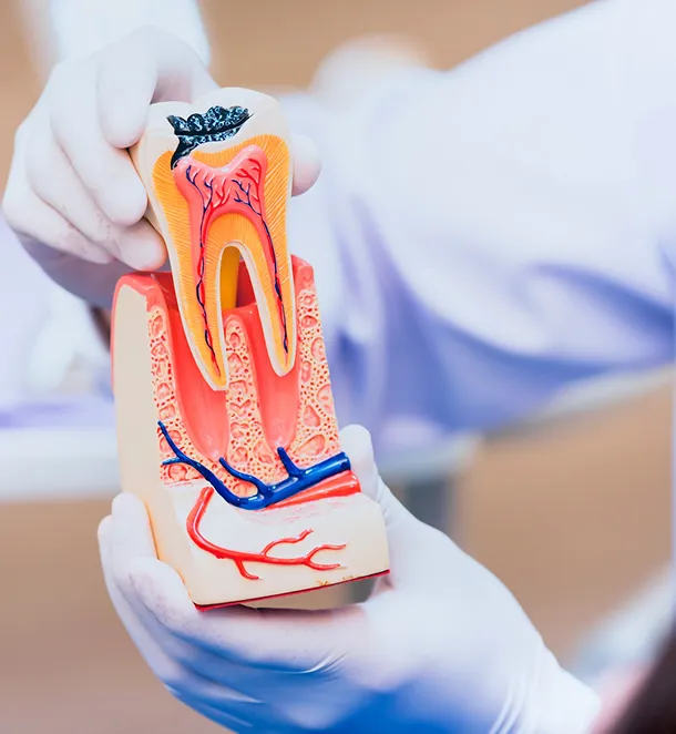 Root Canal Treatment Cost In Dubai