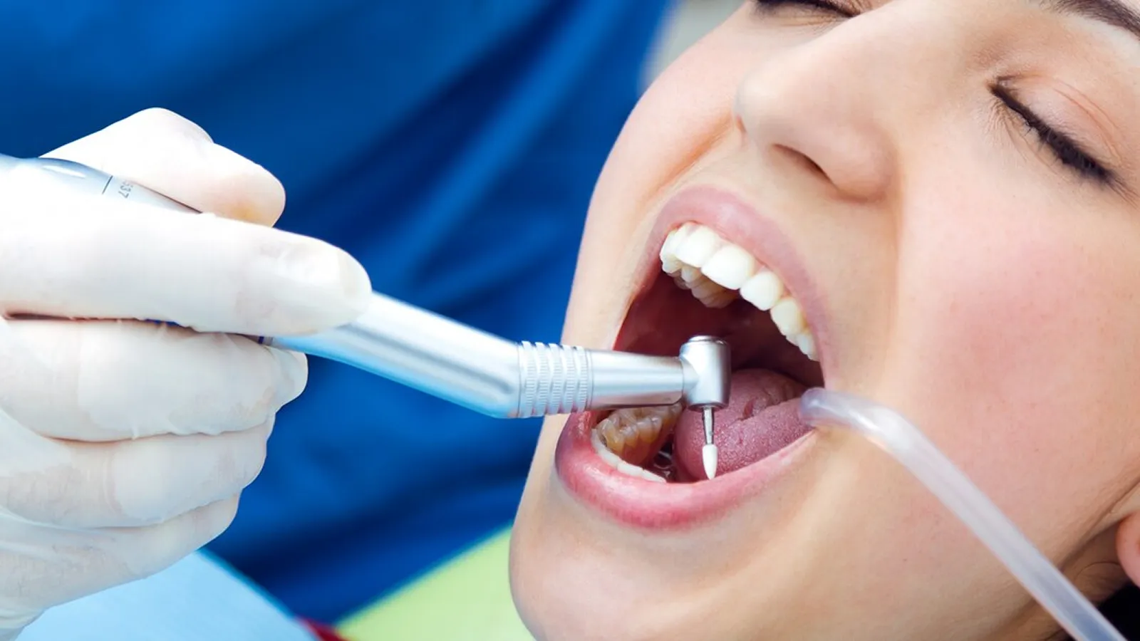 Patient in dental chair during teeth extraction consultation