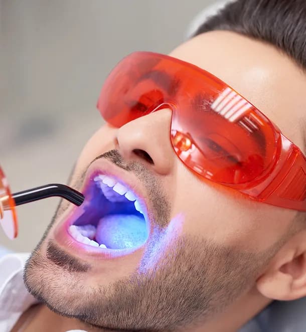 Professional Teeth Whitening Cost In Dubai