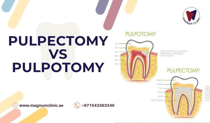 Painless Pulpotomy vs Pulpectomy: What’s the Difference, and Which One Is Right?