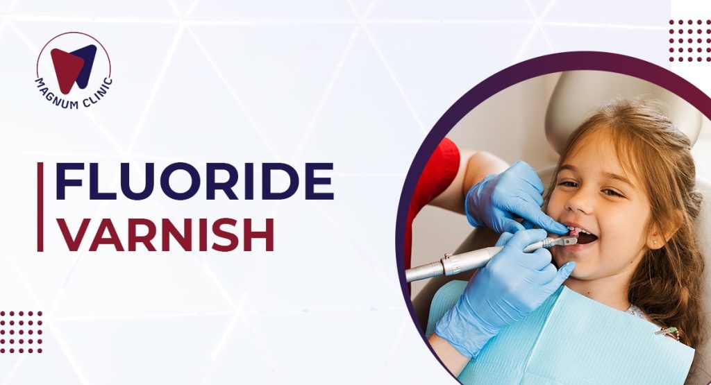 Fluoride Varnish Dental Treatment, Indications and Contraindications