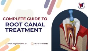 Root Canal Treatment: Procedure, Benefits and Aftercare