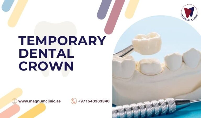 Temporary Dental Crowns Things You Don’t Know Yet