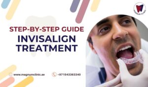 Invisalign Treatment Process: Step-by-Step Guide