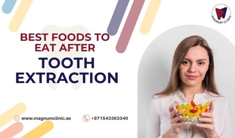 the-best-foods-to-eat-after-tooth-extraction-soft-diet-ideas