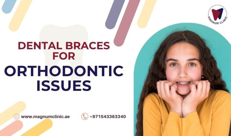 How Long You Need To Wear Dental Braces For Orthodontic Issues?