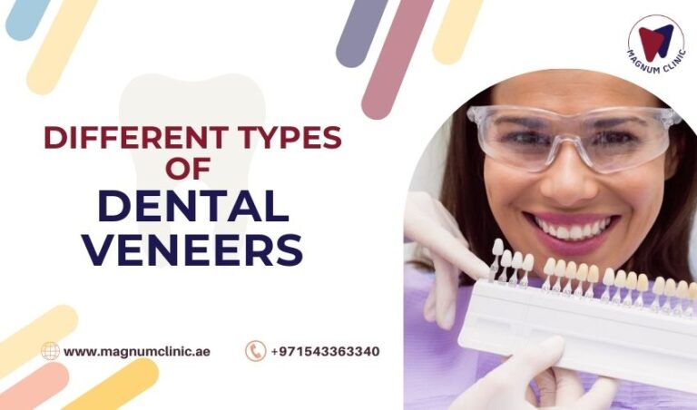 Types Of Dental Veneers And Their Advantages And Disadvantages