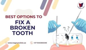 How To Fix Broken Tooth | 7 Options To Fix chipped Tooth