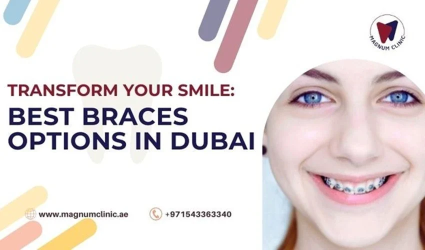 Magnum Dental Clinic -Types of Dental Braces in Dubai - Which One is Right for You