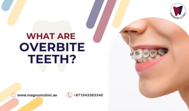 what-are-overbite-teeth-symptoms-and-how-is-it-corrected